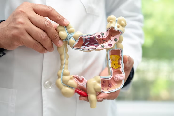 A doctor in a white coat holds up a model of a digestive system.